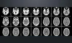 Learning and memory in the brain: a guide for teachers