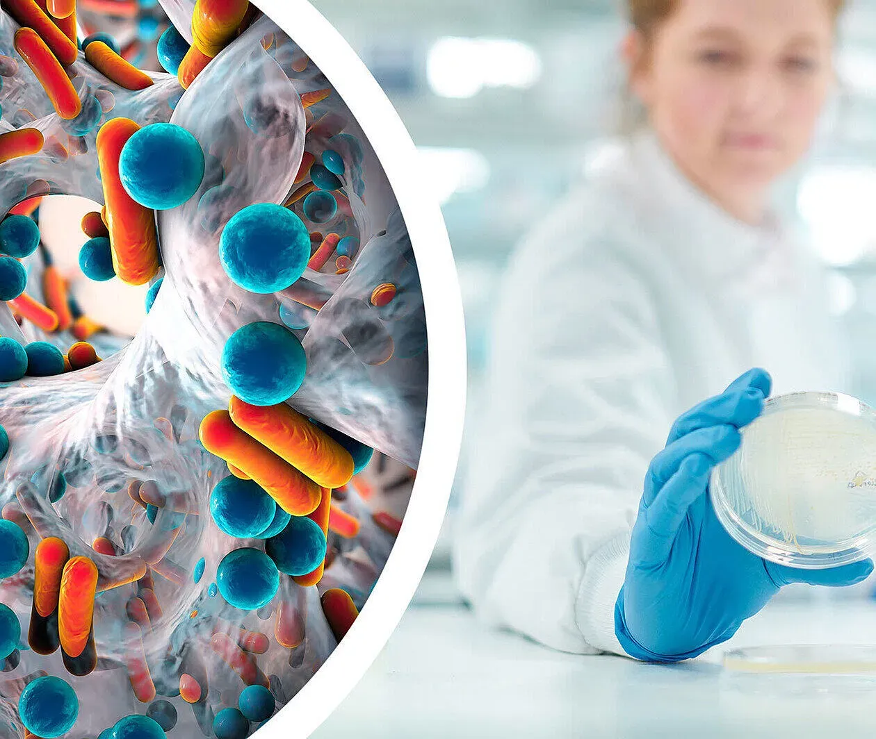 The Role of Diagnostics in the Antimicrobial Resistance Response