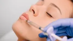 Fillers: Hyaluronic acid injections from plastic surgeon!